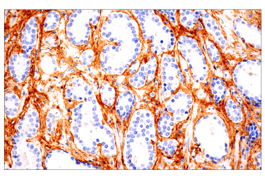 Immunohistochemistry Image 2: COL1A1 (E8F4L) Rabbit Monoclonal Antibody