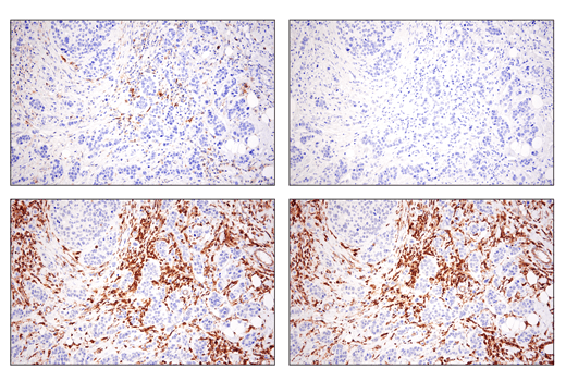 Immunohistochemistry Image 3: Phospho-SLP-76 (Ser376) (E3G9U) Rabbit Monoclonal Antibody (BSA and Azide Free)