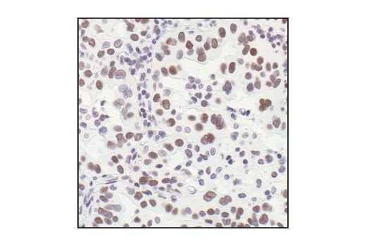 undefined Image 37: HSP/Chaperone Antibody Sampler Kit