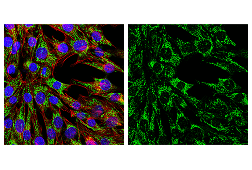 Immunofluorescence Image 1: MAVS (E8Z7M) Rabbit Monoclonal Antibody (BSA and Azide Free)
