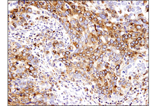 Immunohistochemistry Image 1: CD74 (D5N3I) Rabbit Monoclonal Antibody
