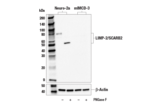 Western Blotting Image 1: LIMP-2/SCARB2 (E2Z5F) Rabbit mAb