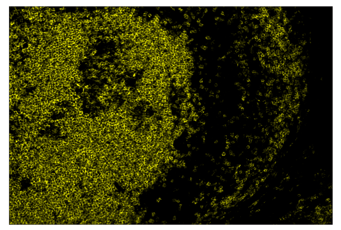 Immunohistochemistry Image 2: CD19 (Intracellular Domain) (D4V4B) & CO-0054-750 SignalStar<sup>™</sup> Oligo-Antibody Pair
