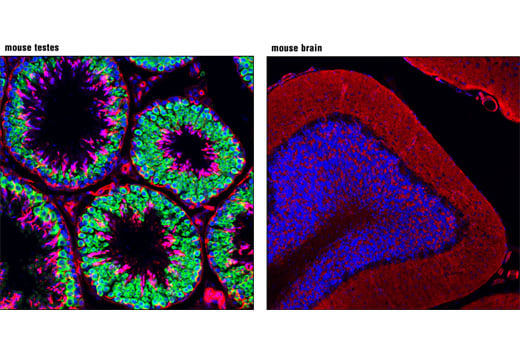 Immunofluorescence Image 1: DDX4 (D10C5) Rabbit Monoclonal Antibody