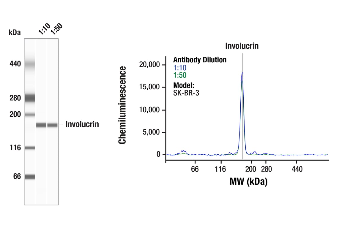 Western Blotting Image 1: Involucrin (F9C3C) Rabbit Monoclonal Antibody
