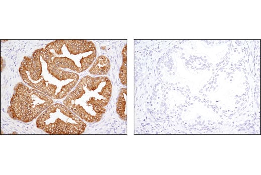 Immunohistochemistry Image 2: PSA/KLK3 (D11E1) Rabbit Monoclonal Antibody (BSA and Azide Free)