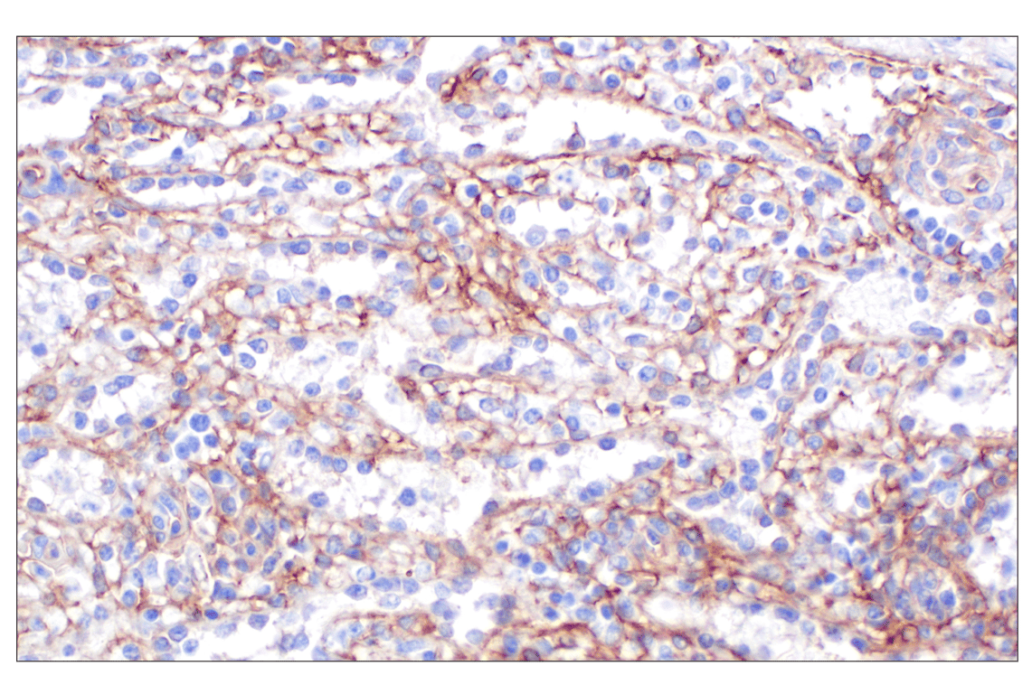 Immunohistochemistry Image 6: CD105/Endoglin (F9C5Q) Rabbit Monoclonal Antibody