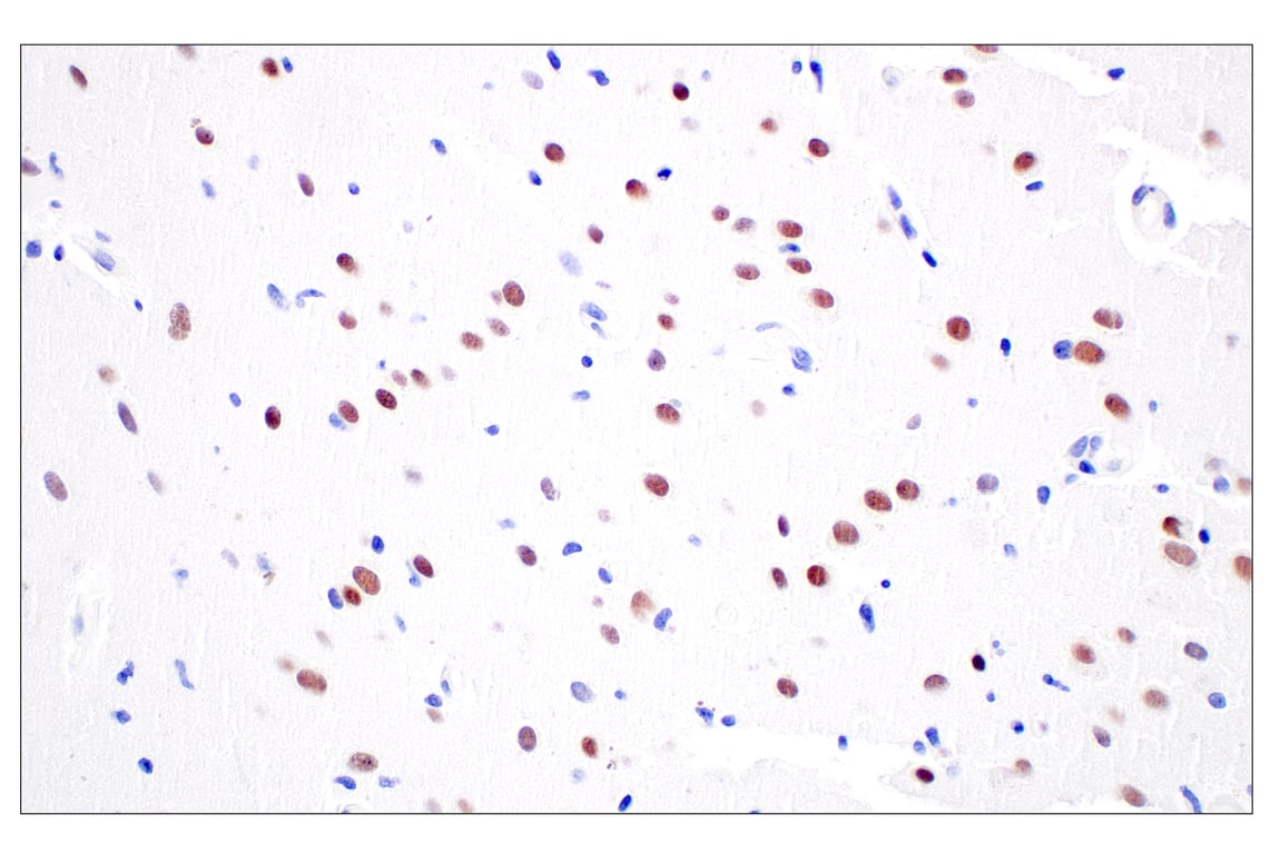 Immunohistochemistry Image 7: FOXG1 (E2W8P) Rabbit Monoclonal Antibody
