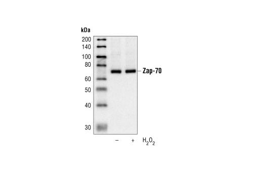 Western Blotting Image 1: Zap-70 (99F2) Rabbit mAb