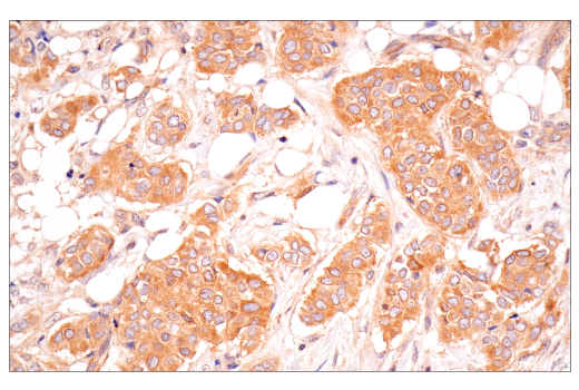 Immunohistochemistry Image 3: B-Raf (E3T5C) Mouse Monoclonal Antibody