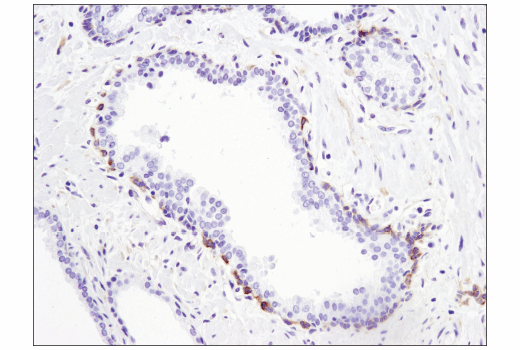 Immunohistochemistry Image 3: STK33 (D3S4R) Rabbit Monoclonal Antibody
