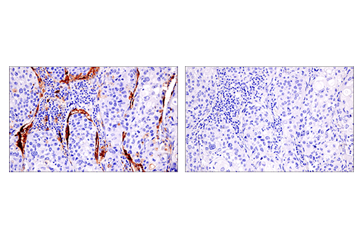 Immunohistochemistry Image 3: HLA-DRA (E9R2Q) XP<sup>®</sup> Rabbit mAb (BSA and Azide Free)