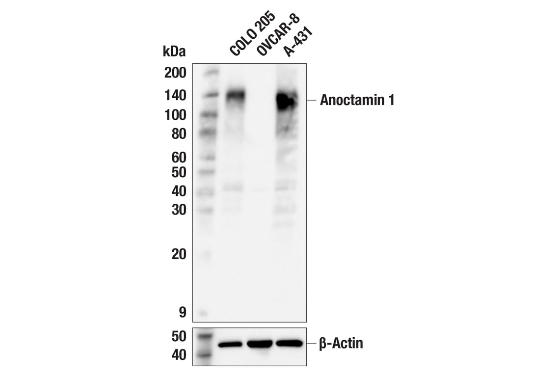 Western Blotting Image 2: DOG1/Anoctamin 1 (F9W4N) Rabbit Monoclonal Antibody