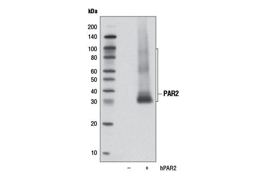 Western Blotting Image 2: PAR2 (D61D5) Rabbit Monoclonal Antibody