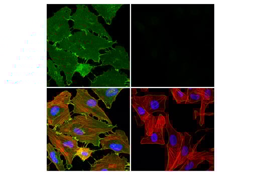 Immunofluorescence Image 1: beta-Catenin (15B8) Mouse Monoclonal Antibody