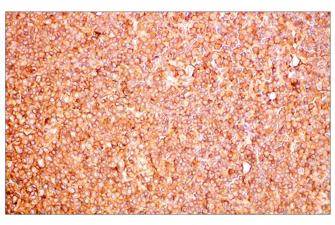 Immunohistochemistry Image 4: MHC Class I (EMR8-5) Mouse Monoclonal Antibody