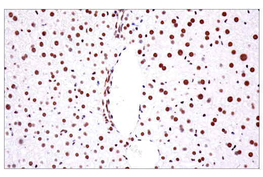 Immunohistochemistry Image 4: TDP43 (E2G6G) Rabbit Monoclonal Antibody