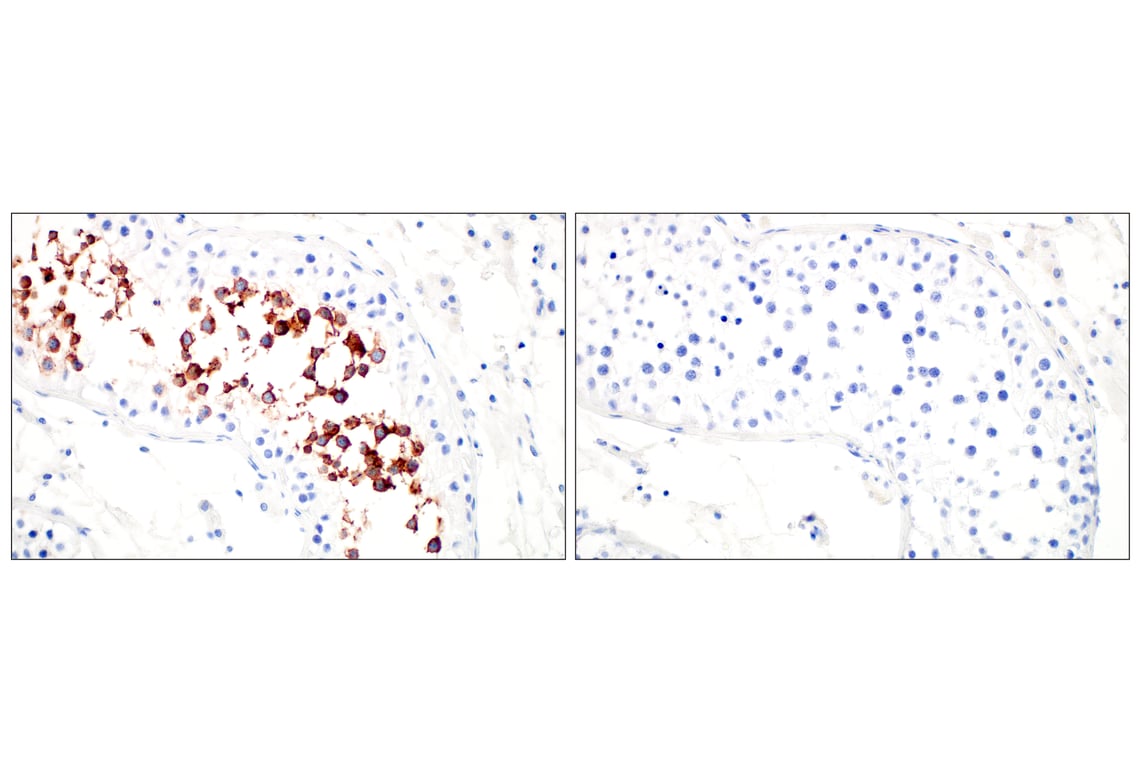 Immunohistochemistry Image 4: GPC2 (CT3) Mouse Monoclonal Antibody
