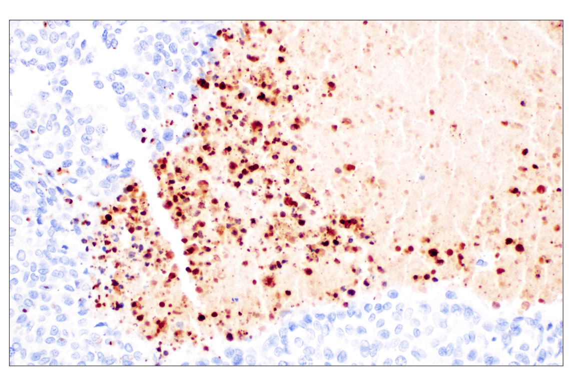 Immunohistochemistry Image 4: Citrullinated Histone H3 (Arg2) (F3C9B) Rabbit mAb (IHC Formulated)