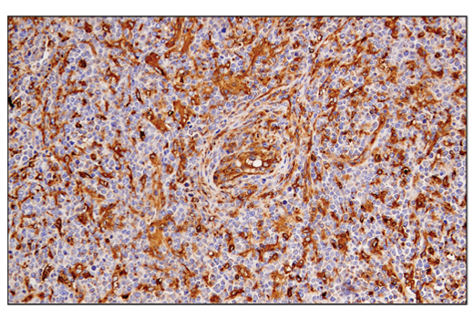 Immunohistochemistry Image 4: MHC Class II (LGII-612.14) Mouse Monoclonal Antibody