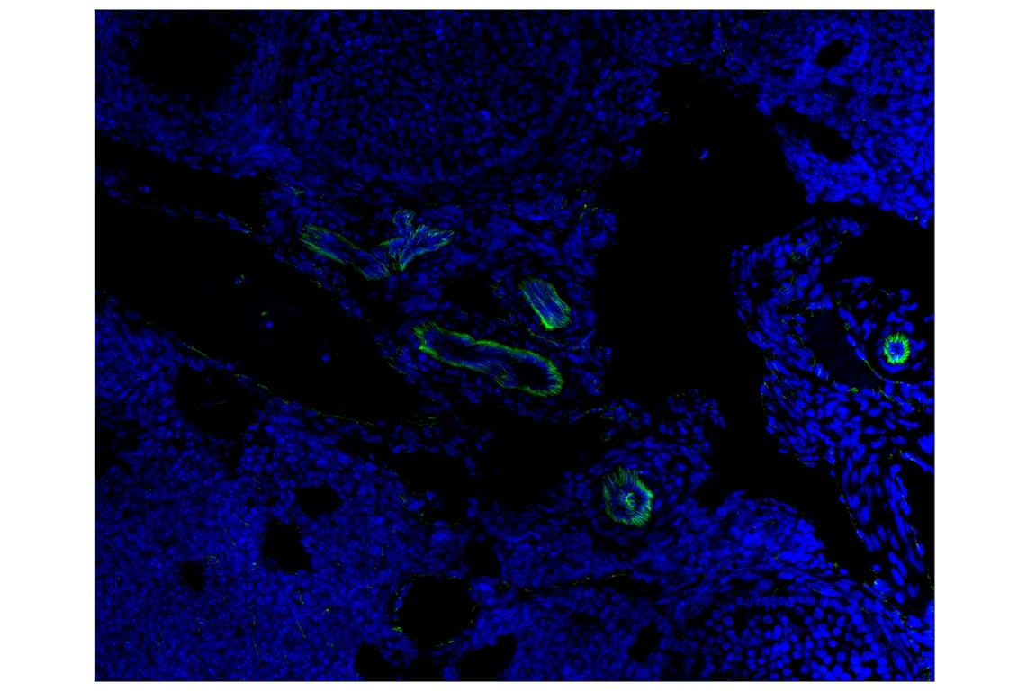 Immunohistochemistry Image 1: CD31 (PECAM-1) (D8V9E) XP<sup>®</sup> Rabbit mAb (Alexa Fluor<sup>®</sup> 488 Conjugate)