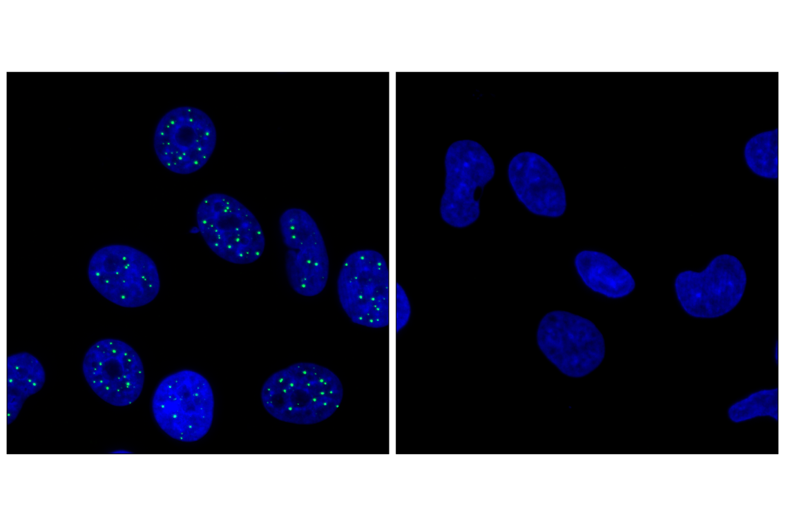 Immunofluorescence Image 1: SP100 (F1H6X) Rabbit Monoclonal Antibody