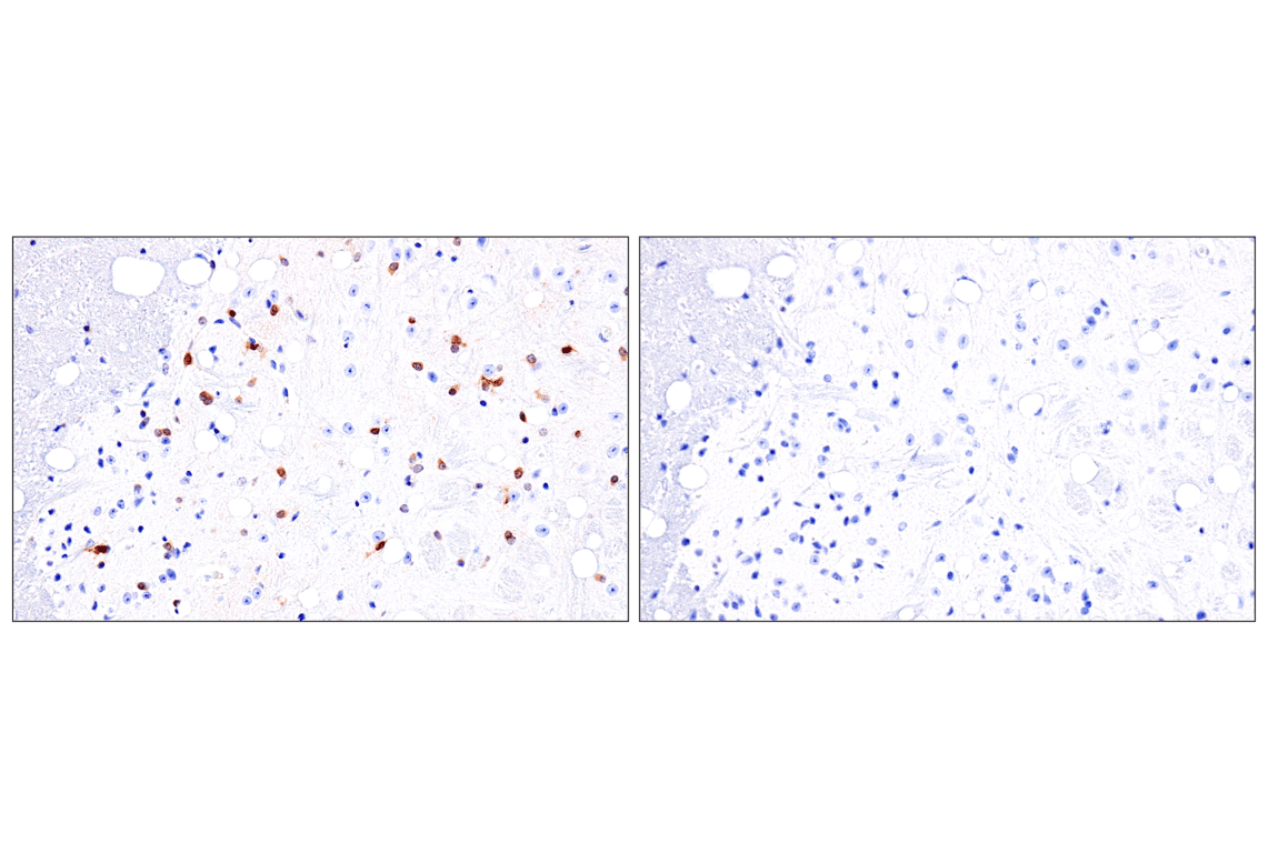 Immunohistochemistry Image 6: Olig1 (E3T6D) Rabbit Monoclonal Antibody