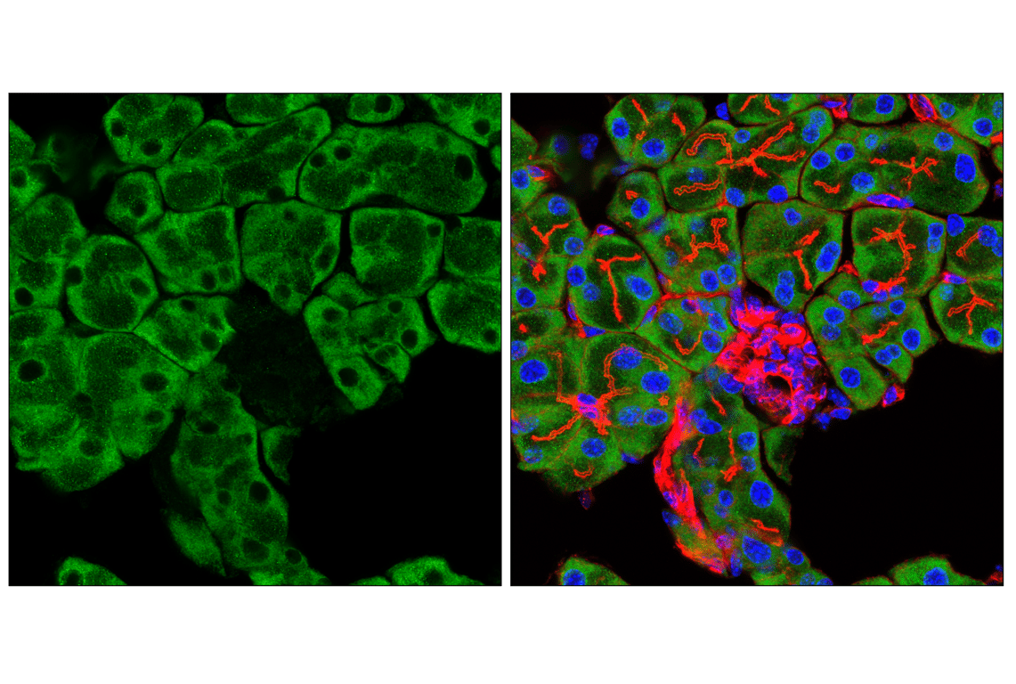 Immunofluorescence Image 2: UFL1 (F5P6L) Rabbit Monoclonal Antibody