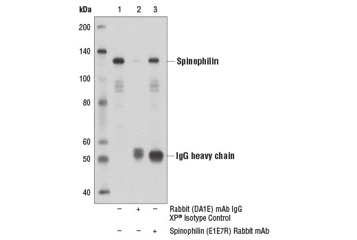Immunoprecipitation Image 1: Spinophilin (E1E7R) Rabbit Monoclonal Antibody