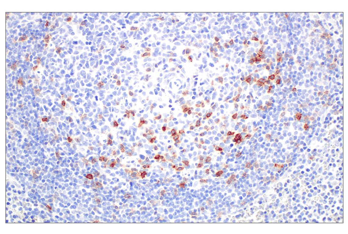 Immunohistochemistry Image 5: ICOS (D1K2T<sup>™</sup>) Rabbit Monoclonal Antibody (BSA and Azide Free)