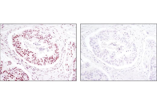 Immunohistochemistry Image 2: SP1 (D4C3) Rabbit Monoclonal Antibody