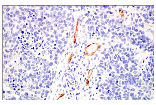Immunohistochemistry Image 4: PLVAP (E3X9D) Rabbit Monoclonal Antibody