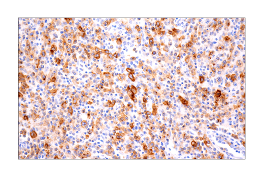 Immunohistochemistry Image 2: TNFRSF8/CD30 (E7E4D) Rabbit Monoclonal Antibody (BSA and Azide Free)