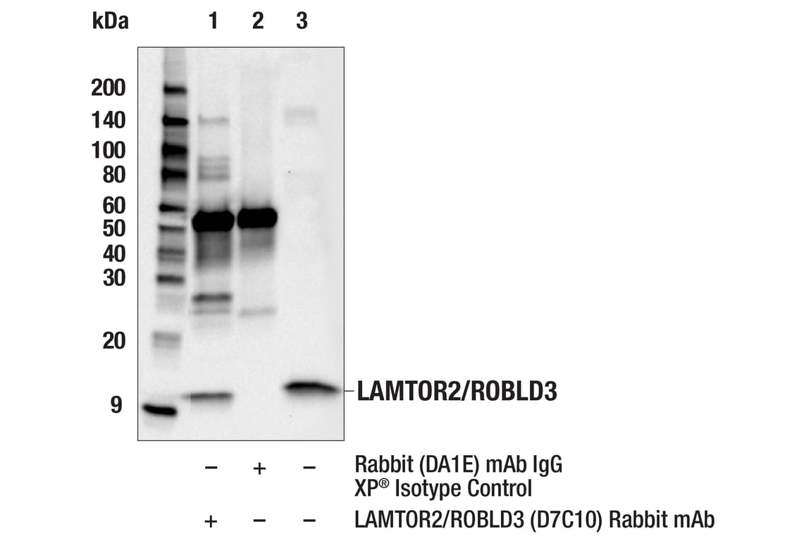 Immunoprecipitation Image 1: LAMTOR2/ROBLD3 (D7C10) Rabbit Monoclonal Antibody