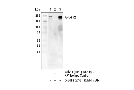 Immunoprecipitation Image 1: GIGYF2 (E7F7I) Rabbit Monoclonal Antibody