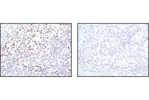 Immunohistochemistry Image 1: CDK9 (C12F7) Rabbit Monoclonal Antibody