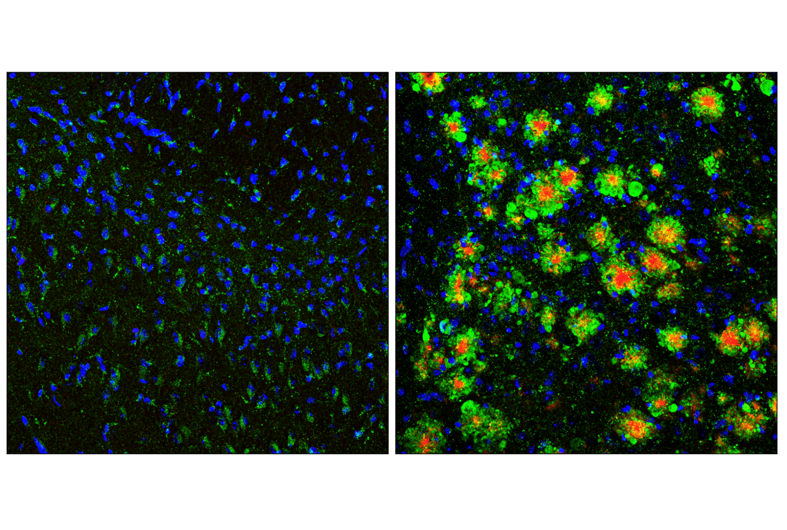 LAMP1 (E5N9Z) Rabbit mAb | Cell Signaling Technology