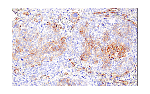 Immunohistochemistry Image 1: CD200 (E5I9V) Rabbit Monoclonal Antibody