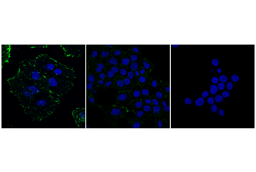 Immunofluorescence Image 1: Mena (E8H6R) Rabbit Monoclonal Antibody