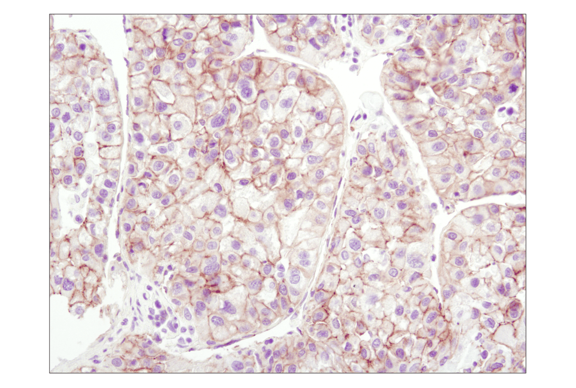 Immunohistochemistry Image 1: beta-Catenin (6B3) Rabbit Monoclonal Antibody