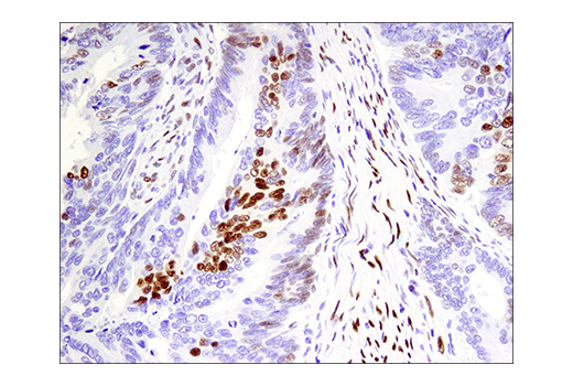 Immunohistochemistry Image 3: Phospho-ATF-2 (Thr71)/ATF-7 (Thr53) (E4A5G) Rabbit Monoclonal Antibody