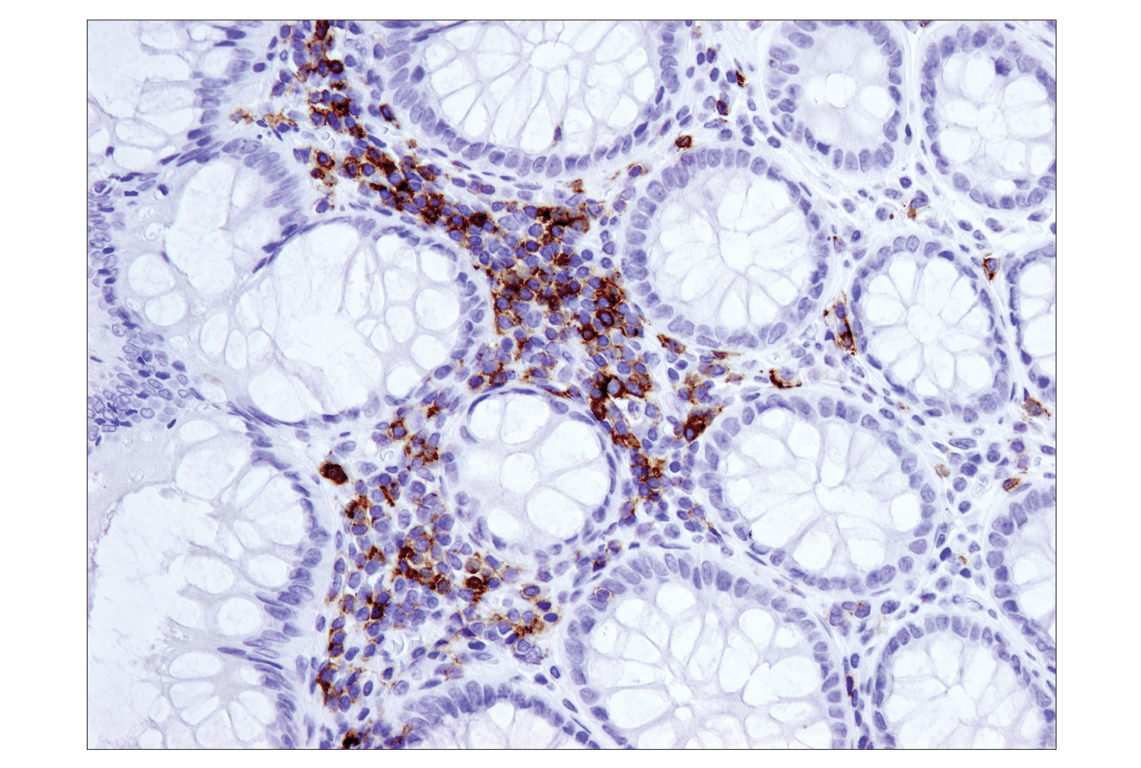 Immunohistochemistry Image 1: ICOS (D1K2T) Rabbit Monoclonal Antibody (BSA and Azide Free)
