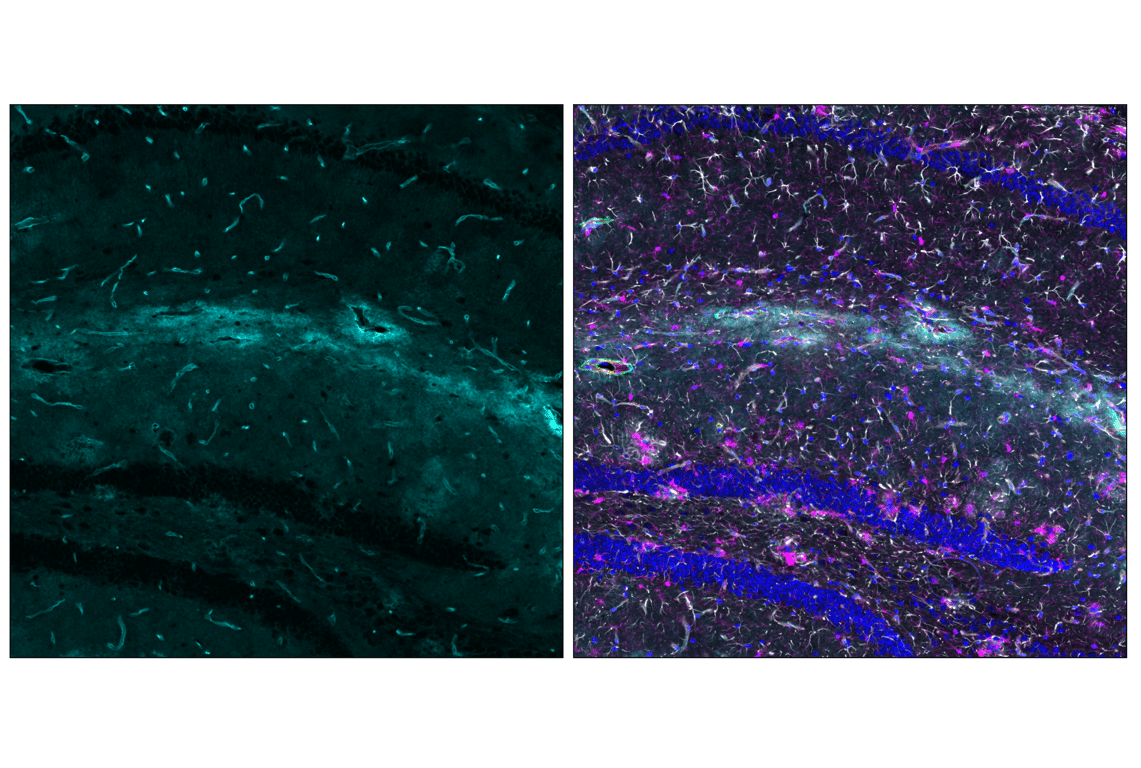 Immunofluorescence Image 5: AQP4 (D1F8E) Rabbit Monoclonal Antibody (Alexa Fluor<sup>®</sup> 647 Conjugate)