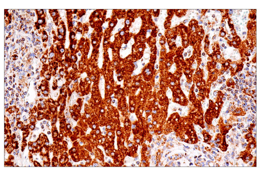 Immunohistochemistry Image 3: SDHB (E3H9Z) Rabbit Monoclonal Antibody