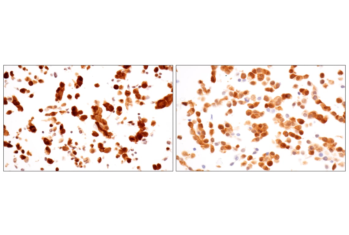Immunohistochemistry Image 17: ACBP/DBI (E4V8V) Rabbit Monoclonal Antibody