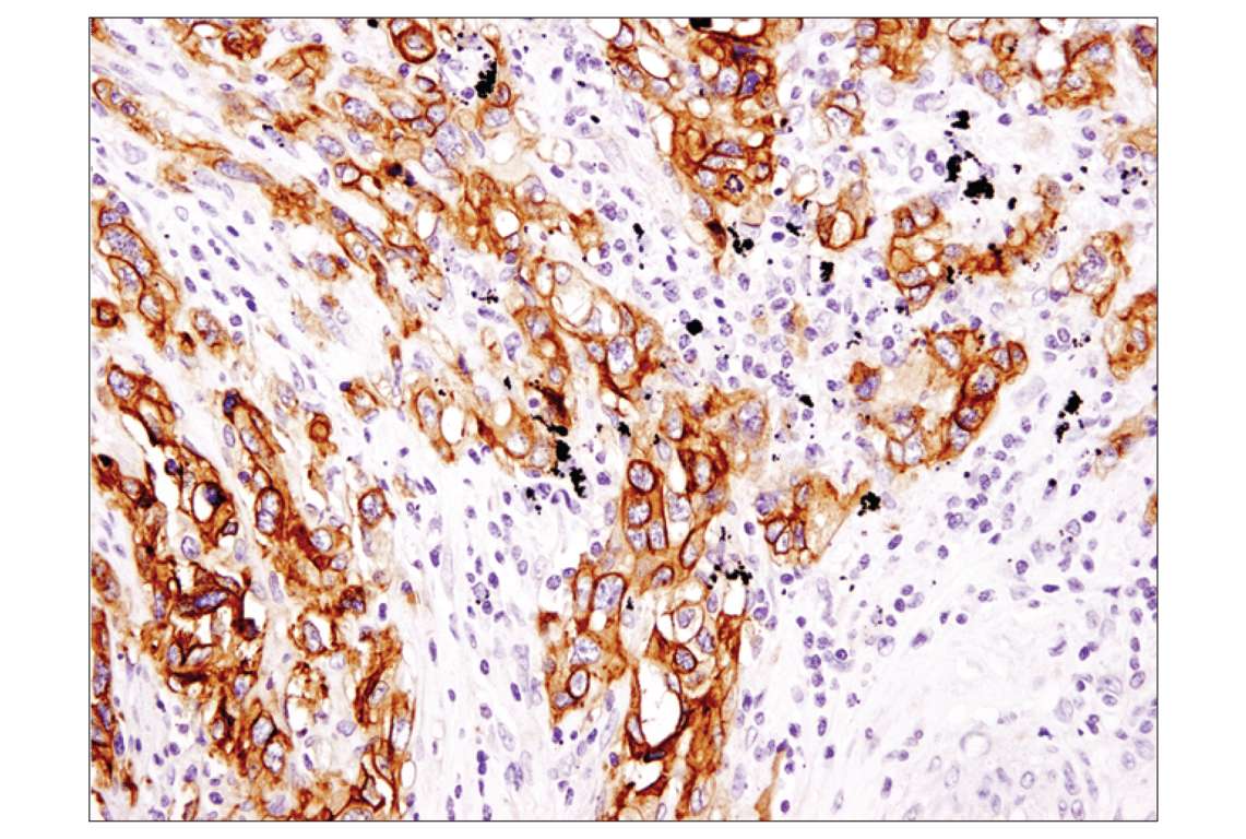 Immunohistochemistry Image 3: EpCAM (D9S3P) Rabbit Monoclonal Antibody (BSA and Azide Free)