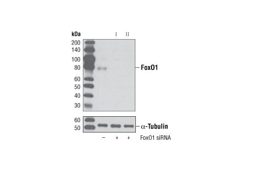 undefined Image 1: SignalSilence<sup>®</sup> FoxO1 siRNA II