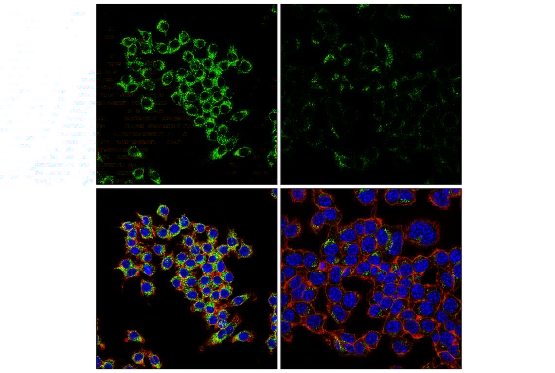 Immunofluorescence Image 1: LAMP2 (E6A6S) Rabbit Monoclonal Antibody