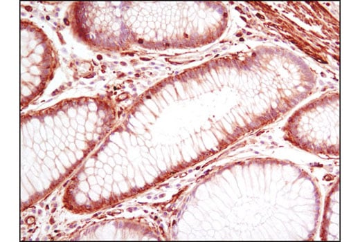 Immunohistochemistry Image 1: Pan-Actin (D18C11) Rabbit Monoclonal Antibody (BSA and Azide Free)