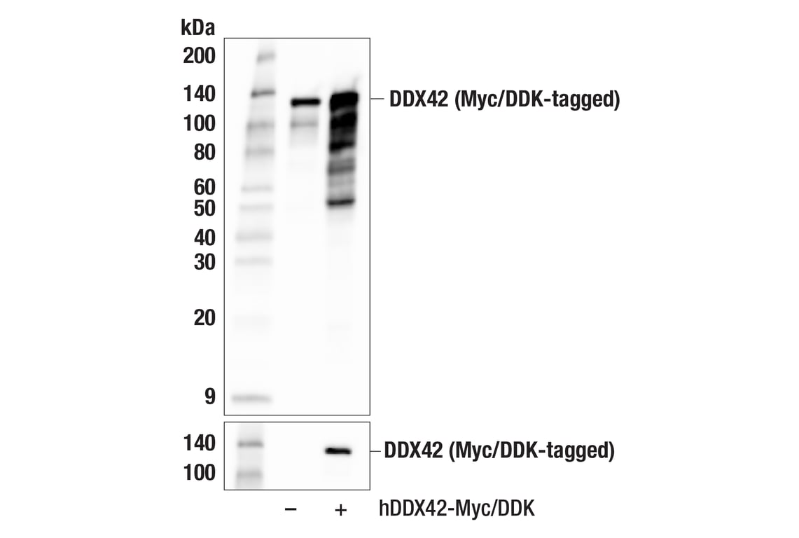 Western Blotting Image 3: DDX42 (F4V2L) Rabbit Monoclonal Antibody